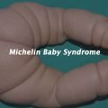 Michelin Baby Syndrome