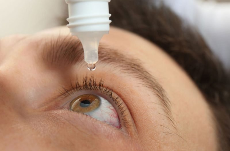 Pros And Cons Of Using Lumify Eye Drops