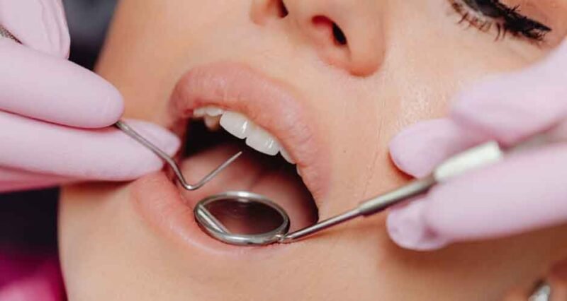 Exploring Dental Implants: Procedure and Versatile Uses in Maple Ridge