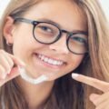 Identifying Ideal Candidates for Invisalign in Surrey