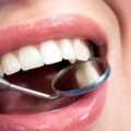 Why-Is-Ongoing-Dental-Care-Important-Even-If-Your-Teeth-Feel-Fine