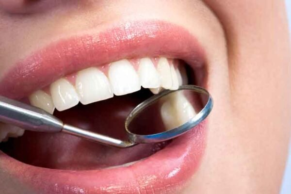 Why Is Ongoing Dental Care Important Even If Your Teeth Feel Fine?