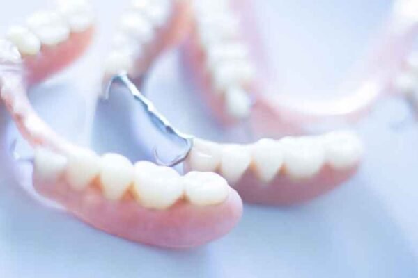 The Future of Full-Arch Dental Solutions