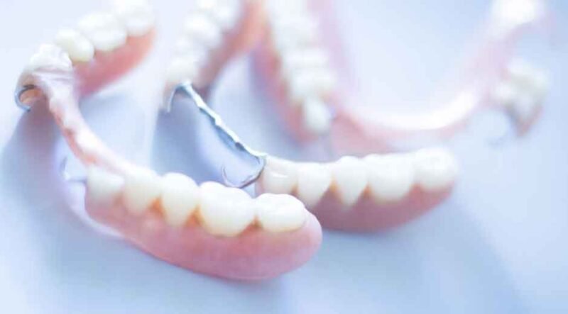 The Future of Full-Arch Dental Solutions
