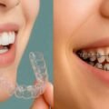 8-Concepts-Every-New-Orthodontic-Provider-Should-Know