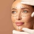 The Intersection of Plastic Surgery and Overall Health