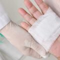 Understanding Wound Care and Its Role in Recovery