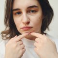 achieving-clearer-skin-a-guide-to-treatments-that-1