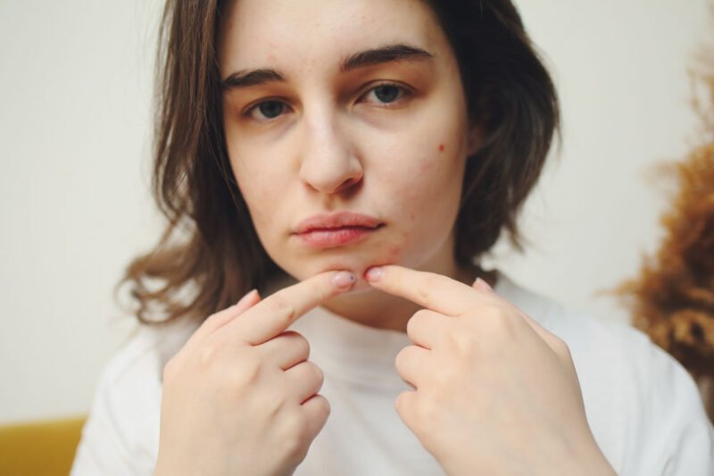 Achieving Clearer Skin: A Guide to Treatments That Tackle Breakouts at the Source